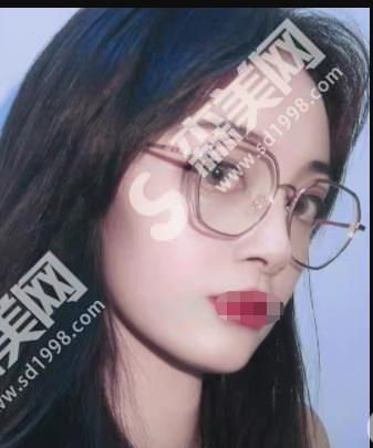 玉泉医院的罗羽医生技术怎么样?附医院介绍及案例分享