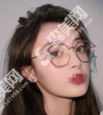 玉泉医院的罗羽医生技术怎么样?附医院介绍及案例分享