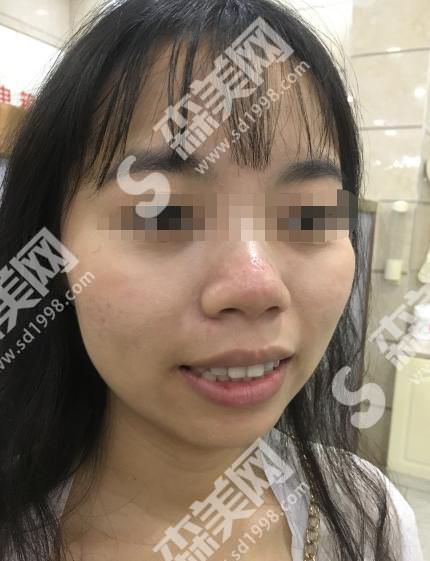 穗华口腔医院正规吗？牙齿整形果怎么样？内含医师介绍和案例分享