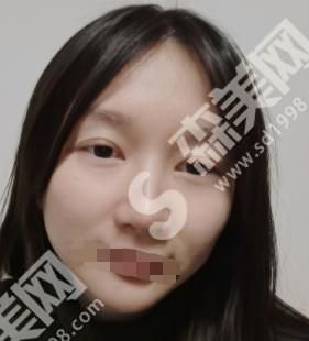 南京柏盛高整形医院做的整形果如何？附医师介绍及案例分享