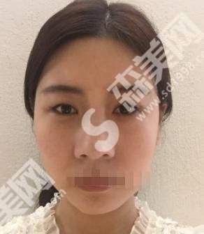 北京联合丽格整形医院做的整形果如何？附医师介绍及案例分享