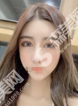 北京联合丽格整形医院做的整形果如何？附医师介绍及案例分享