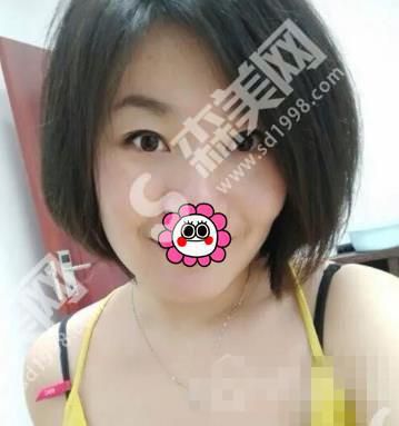 山东省立医院整形美容外科怎么样？医生介绍+案例分享