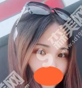 长安医院整形美容科靠谱吗？附医生介绍及真人双眼皮案例分享