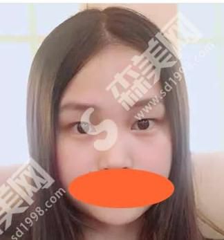 长安医院整形美容科靠谱吗？附医生介绍及真人双眼皮案例分享