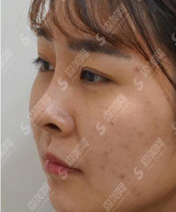 九院美白价格浏览?2021价格表出炉+陈辉专家案例分享