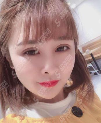 九院美白价格浏览?2021价格表出炉+陈辉专家案例分享