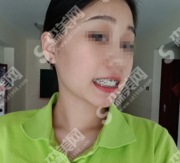 广大口腔医院是正规医院吗？内含医师介绍和牙齿整形案例分享