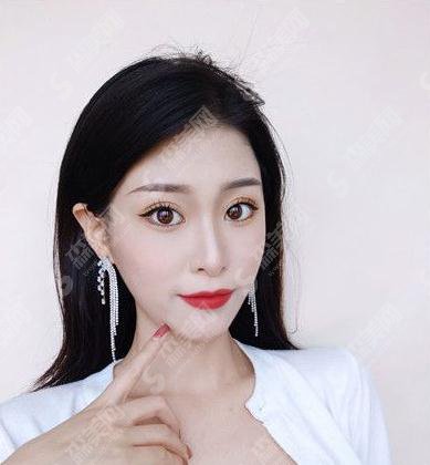 陕西省人民医院慕生枝切开双眼皮技术好吗？案例供参～价格公布