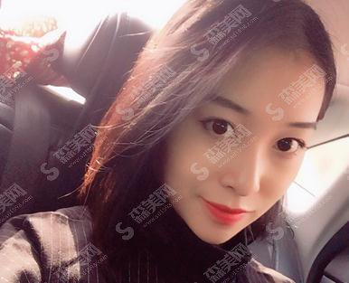 湖南长沙人民医院李高峰双眼皮价格表出炉了，含整形案例恢复对比照