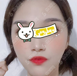 沧州华美和静港哪个好?附光子嫩肤案例对比图一览