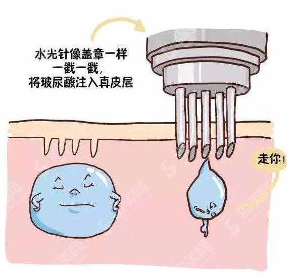 热玛吉——肌肤年轻的秘密~ 医学抗衰的方法有哪些?