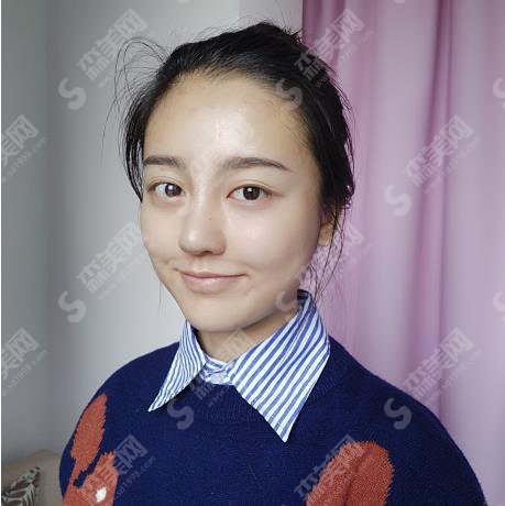 北京整形医院哪家好?北京八大处隆鼻价格表出炉!含整形案例果对比图