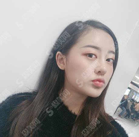 北京整形医院哪家好?北京八大处隆鼻价格表出炉!含整形案例果对比图