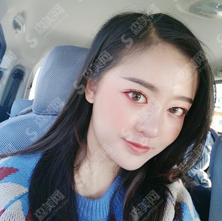 北京整形医院哪家好?北京八大处隆鼻价格表出炉!含整形案例果对比图