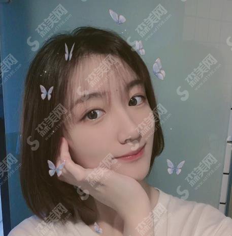 天后整形武连生隆鼻做的怎么样?专家案例~价格收费在线参考?