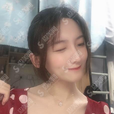 天后整形武连生隆鼻做的怎么样?专家案例~价格收费在线参考?