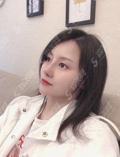 修志夫隆鼻多少钱？价格查询及假体隆鼻案例图片欣赏