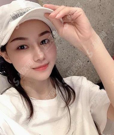 修志夫隆鼻多少钱？价格查询及假体隆鼻案例图片欣赏