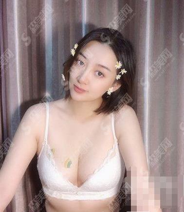 三甲医院有整形外科吗？上海九院整形外科脂肪隆胸多少钱？隆胸案例分享