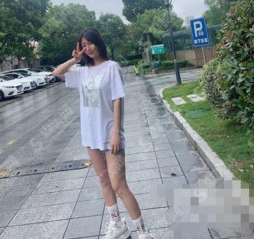 开封华忆医疗美容医院吸脂瘦腿案例前后对比图!分享吸脂瘦身整形价格标准