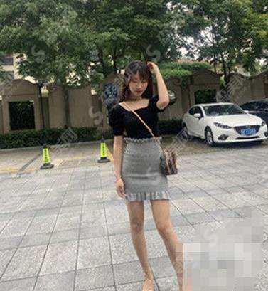 开封华忆医疗美容医院吸脂瘦腿案例前后对比图!分享吸脂瘦身整形价格标准