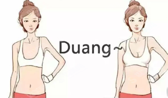 假体隆胸真人果案例分享,附隆胸价目表