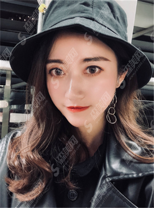 热玛吉是啥?主要的原理是什么?术后需要注意什么