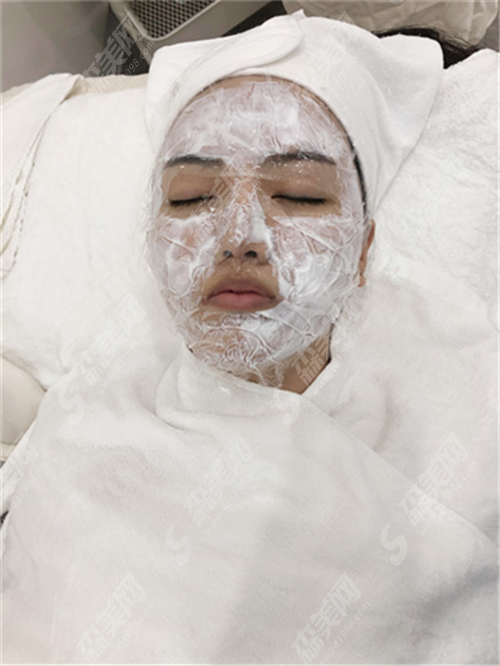 热玛吉一般多少岁开始做?用它去除皱术靠谱吗?