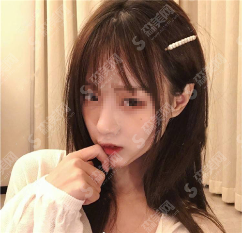 热玛吉果能维持多久?热玛吉去眼袋管用吗?需要注意什么?