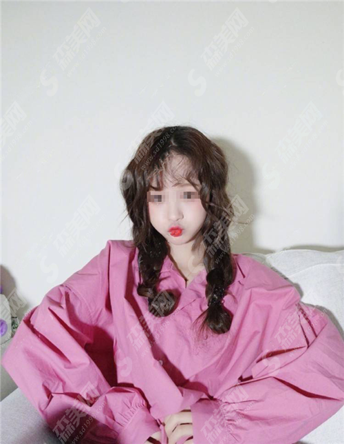 热玛吉果能维持多久?热玛吉去眼袋管用吗?需要注意什么?