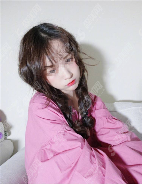 热玛吉果能维持多久?热玛吉去眼袋管用吗?需要注意什么?