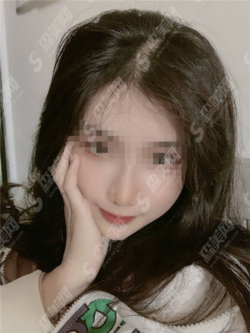 全脸热玛吉一次多少钱?到底贵不贵呢?