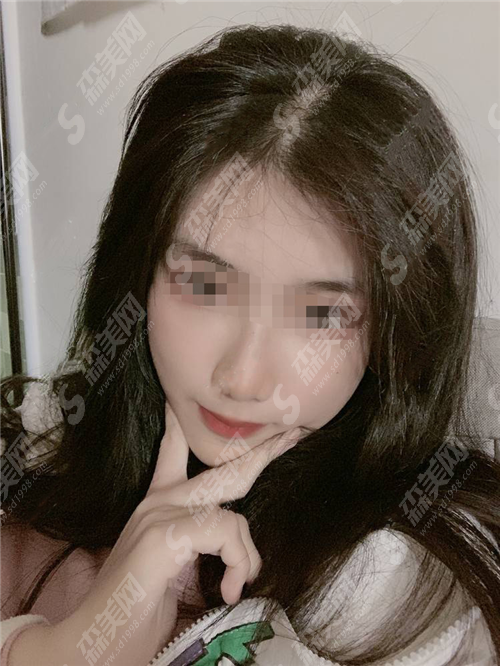 全脸热玛吉一次多少钱?到底贵不贵呢?