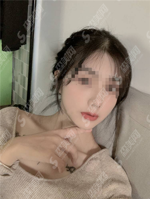 全脸热玛吉一次多少钱?到底贵不贵呢?