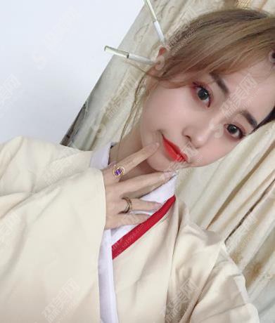华仁整形美容医院隆鼻整形价格表出炉啦!含整形案例果对比照