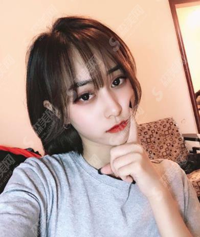 华仁整形美容医院隆鼻整形价格表出炉啦!含整形案例果对比照