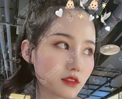 江门市口腔医院牙齿矫正多少钱?公布价格区间及成功案例