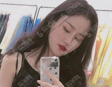 江门市口腔医院牙齿矫正多少钱?公布价格区间及成功案例