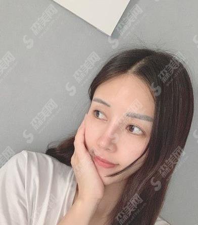 郑州华山医院植发怎么样?毛发移植术真实案例分享及价格参考