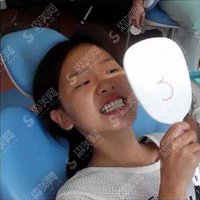 西安中诺口腔医院正规吗？西安中诺口腔医院牙齿矫正果案例对比图来了，还有价目表