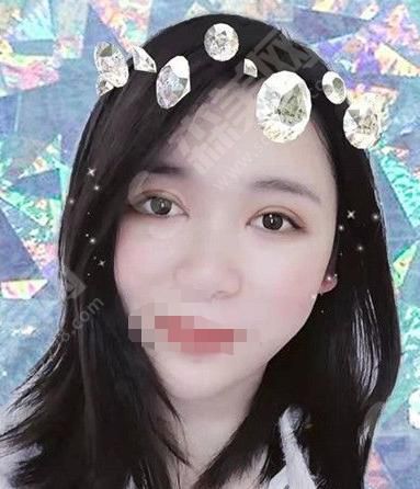 邯郸李婷整形医院李婷医生技术怎么样？值得推荐吗？