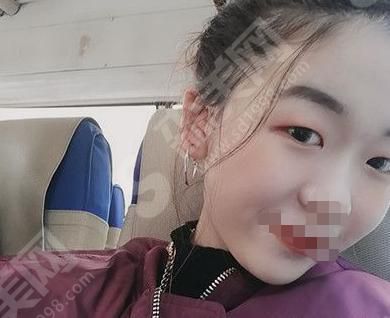邯郸李婷整形医院李婷医生技术怎么样？值得推荐吗？