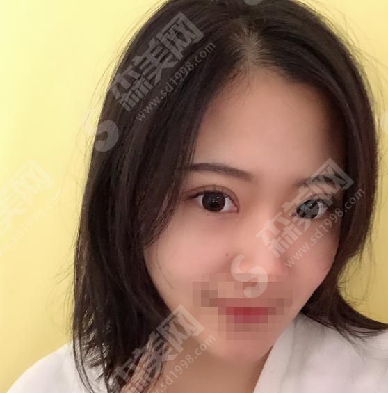 长沙哪家整形医院靠谱？附亚韩整形案例分享