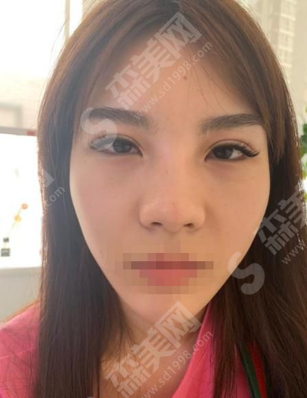 郑州哪家整容医院口碑好？内含医院介绍及案例分享