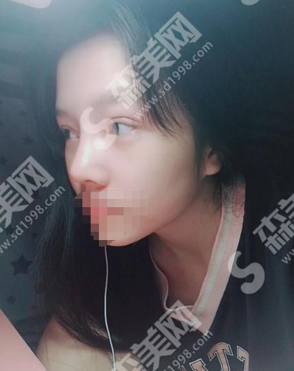 郑州俪侬整形医院电话是多少？整形果怎么样？