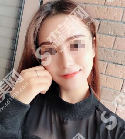 郑州美立方医疗美容医院做的鼻子怎么样?附医师介绍及案例分享