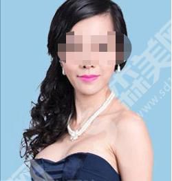 郑州华山医院做的隆胸果如何?真人案例来袭~