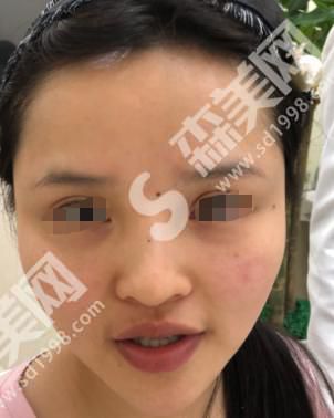 襄阳中心医院美容科做的整形果如何？附医师介绍及案例分享