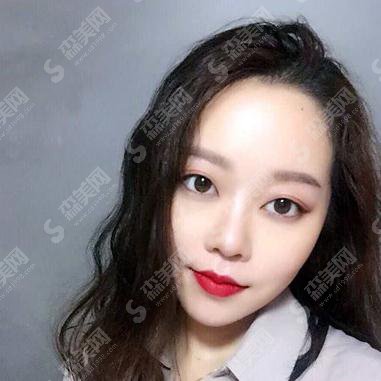 济南旭美整形医院隆鼻怎么样？案例分享及价格表出炉